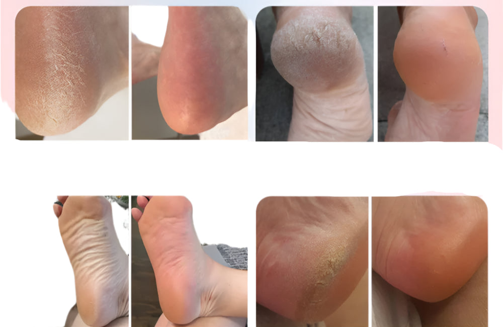 SINTIVO™ Elektrische Voetvijl