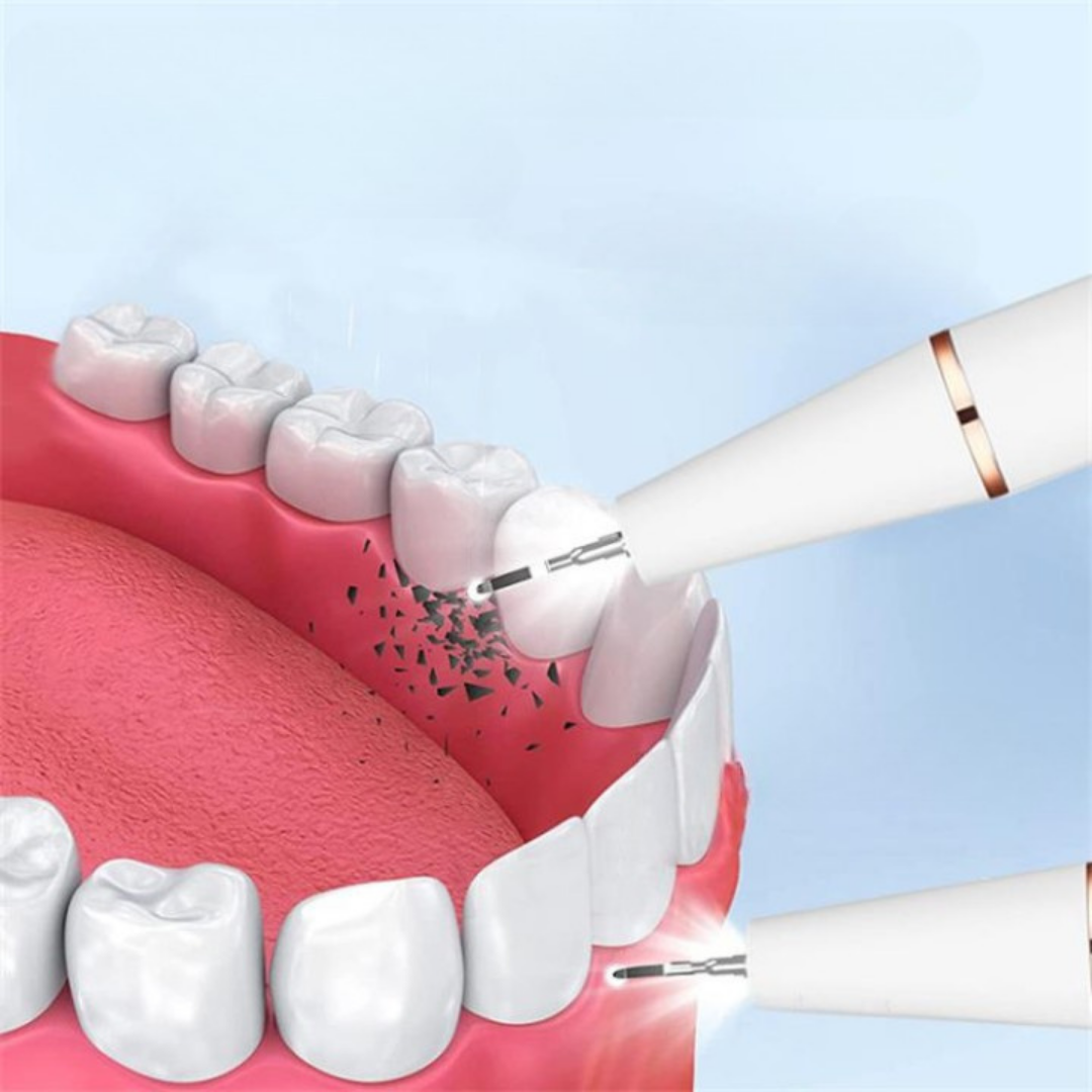 SINTIVO™ Ultrasone tandsteenverwijderaar