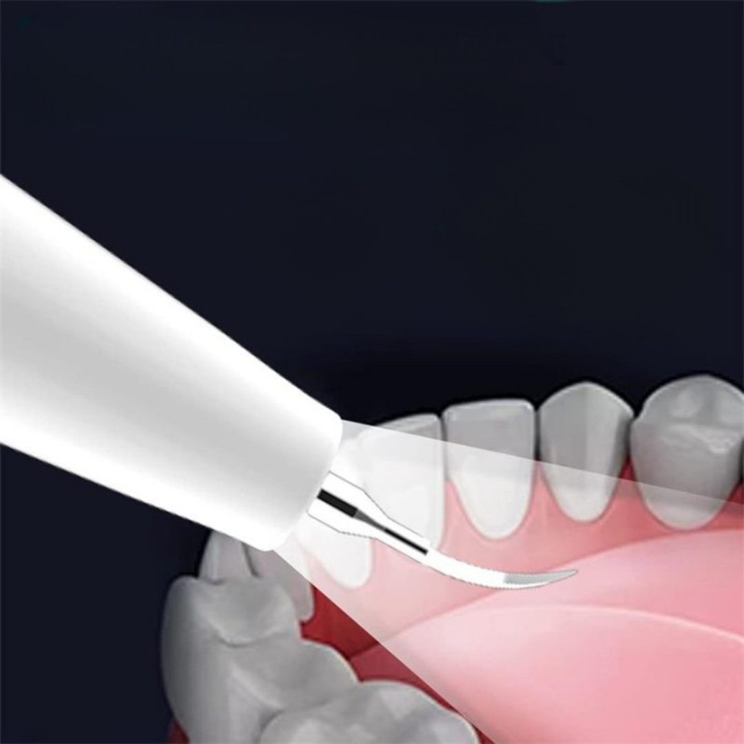 SINTIVO™ Ultrasone tandsteenverwijderaar