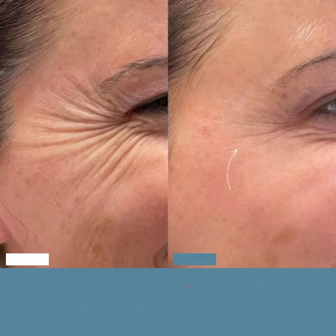 SINTIVO™ Zacht Anti-Aging Gereedschap