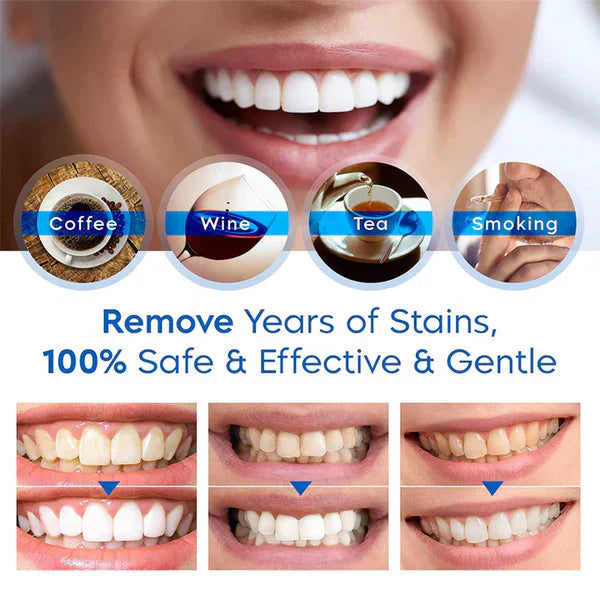 SINTIVO™ Tandenbleek Set