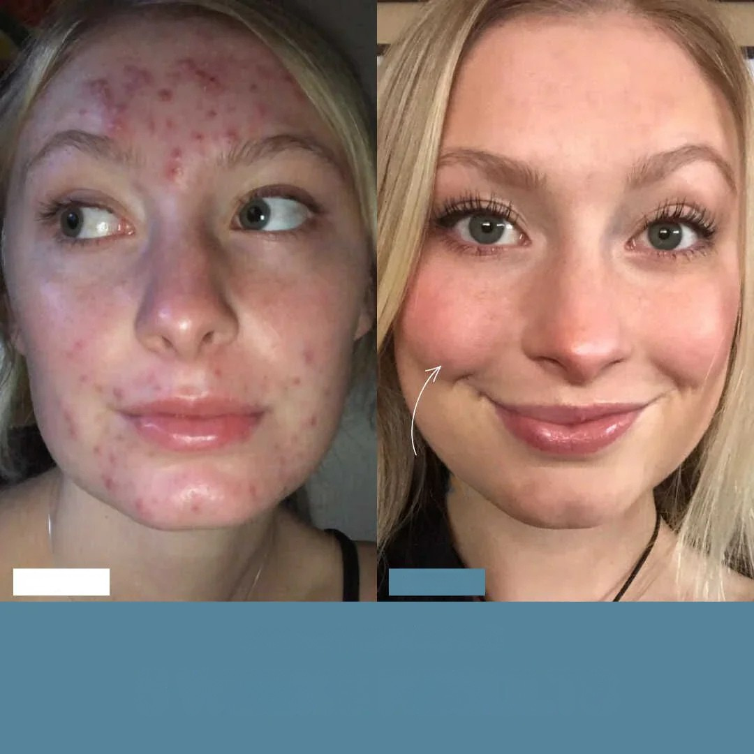SINTIVO™ Zacht Anti-Aging Gereedschap